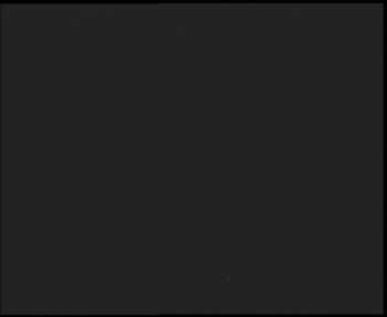 SkiAreál - Horský hotel...