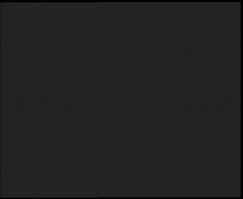 SkiAreál - Horský hotel...