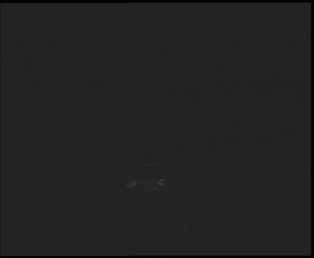 SkiAreál - Horský hotel...