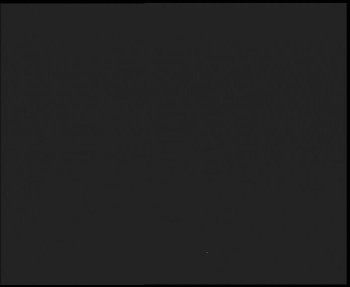 SkiAreál - Horský hotel...