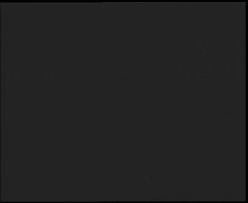 SkiAreál - Horský hotel...