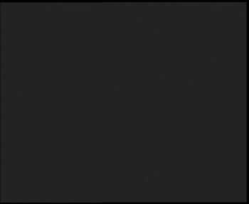 SkiAreál - Horský hotel...