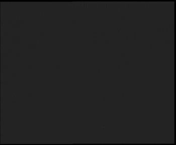 SkiAreál - Horský hotel...