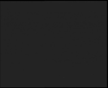 SkiAreál - Horský hotel...