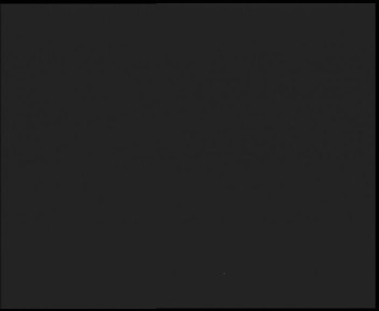 SkiAreál - Horský hotel...