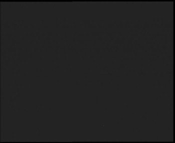 SkiAreál - Horský hotel...