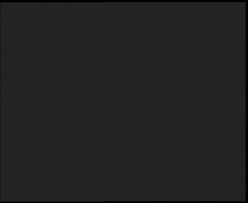 SkiAreál - Horský hotel...