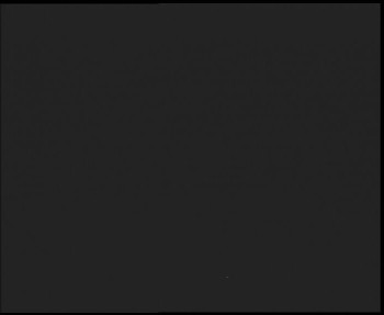 SkiAreál - Horský hotel...