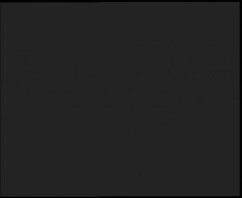 SkiAreál - Horský hotel...