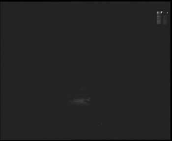 SkiAreál - Horský hotel...