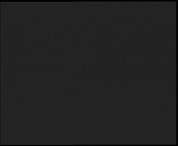 SkiAreál - Horský hotel...