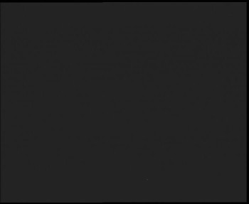 SkiAreál - Horský hotel...