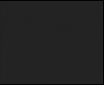 SkiAreál - Horský hotel...