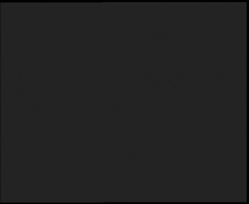 SkiAreál - Horský hotel...