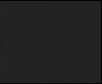 SkiAreál - Horský hotel...