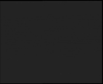 SkiAreál - Horský hotel...