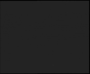 SkiAreál - Horský hotel...