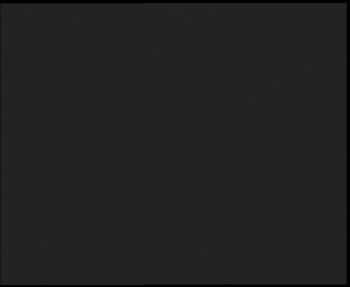 SkiAreál - Horský hotel...