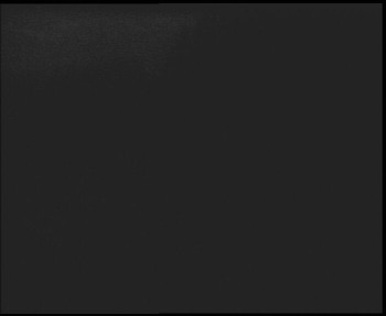 SkiAreál - Horský hotel...