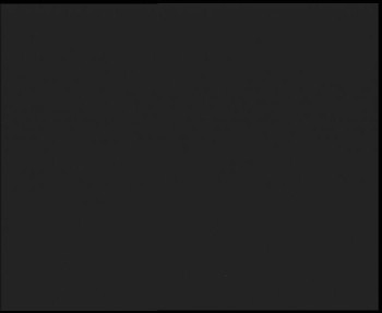 SkiAreál - Horský hotel...