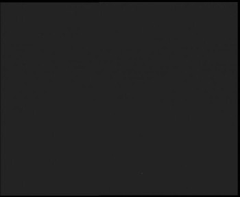 SkiAreál - Horský hotel...