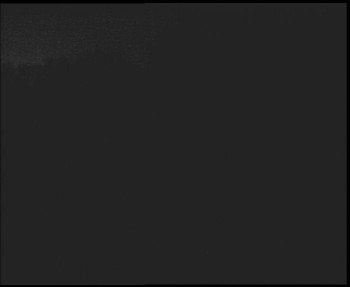 SkiAreál - Horský hotel...