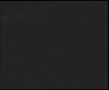 SkiAreál - Horský hotel...