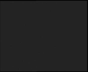 SkiAreál - Horský hotel...