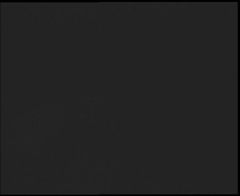 SkiAreál - Horský hotel...