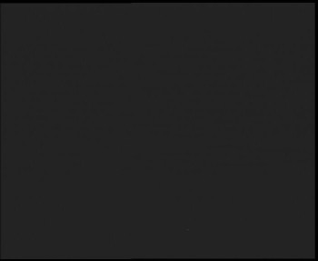 SkiAreál - Horský hotel...