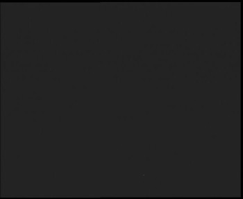 SkiAreál - Horský hotel...