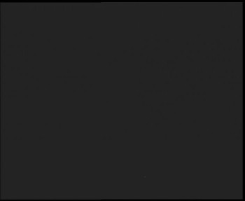 SkiAreál - Horský hotel...