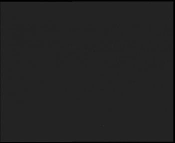 SkiAreál - Horský hotel...