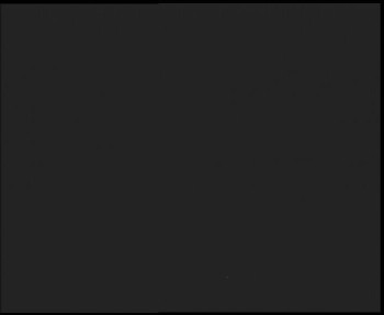 SkiAreál - Horský hotel...