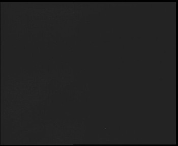 SkiAreál - Horský hotel...