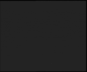 SkiAreál - Horský hotel...