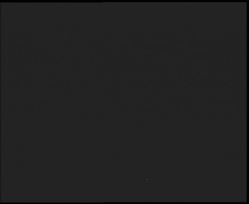 SkiAreál - Horský hotel...