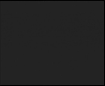 SkiAreál - Horský hotel...