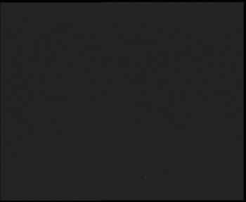 SkiAreál - Horský hotel...