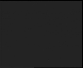 SkiAreál - Horský hotel...