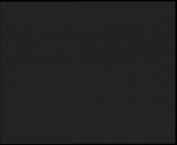 SkiAreál - Horský hotel...