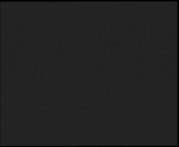 SkiAreál - Horský hotel...