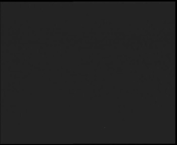 SkiAreál - Horský hotel...