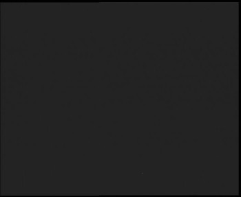 SkiAreál - Horský hotel...