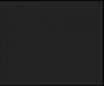 SkiAreál - Horský hotel...