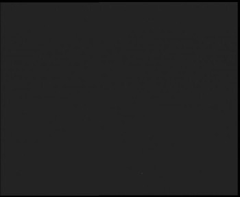 SkiAreál - Horský hotel...