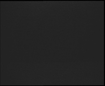 SkiAreál - Horský hotel...