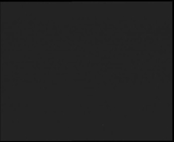 SkiAreál - Horský hotel...