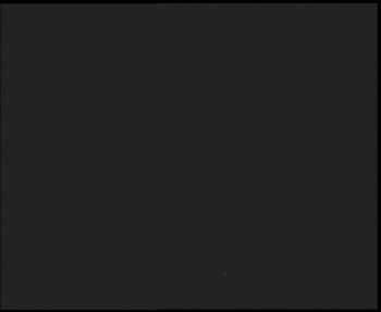 SkiAreál - Horský hotel...