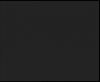 SkiAreál - Horský hotel...